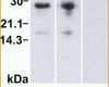 Hervorragend Allergene Speisekarte Vorlage Frisch Deklaration Von